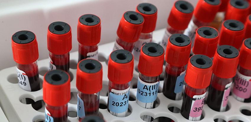 За сутки в Беларуси зарегистрированы 945 пациентов с COVID-19, выписаны 248