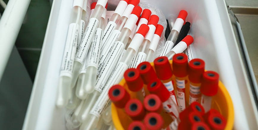 За сутки в Беларуси зарегистрированы 943 пациента с COVID-19, выписаны 1363