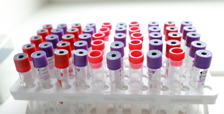 За сутки в Беларуси зарегистрированы 582 пациента с COVID-19, выписаны 882