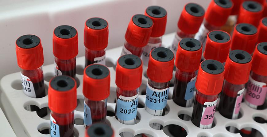 За сутки в Беларуси зарегистрированы 656 пациентов с COVID-19, выписаны 204