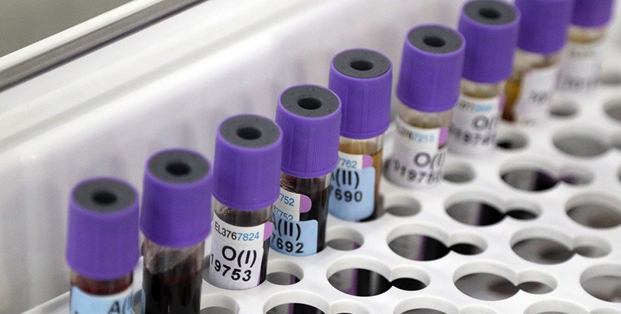 За сутки в Беларуси зарегистрированы 1213 пациентов с COVID-19, выписаны 1169